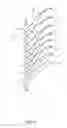 Fig. 10 - BRAKE PAD MEASURING GAUGE