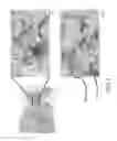 Fig. 02 - IMMUNOHISTOCHEMICAL ASSAY FOR DETECTING EXPRESSION OF PROGRAMMED DEATH LIGAND 1 (PD-L1) IN TUMOR TISSUE