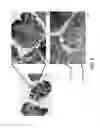 Fig. 03 - IMMUNOHISTOCHEMICAL ASSAY FOR DETECTING EXPRESSION OF PROGRAMMED DEATH LIGAND 1 (PD-L1) IN TUMOR TISSUE