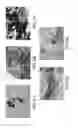 Fig. 05 - IMMUNOHISTOCHEMICAL ASSAY FOR DETECTING EXPRESSION OF PROGRAMMED DEATH LIGAND 1 (PD-L1) IN TUMOR TISSUE