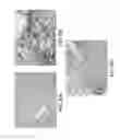 Fig. 07 - IMMUNOHISTOCHEMICAL ASSAY FOR DETECTING EXPRESSION OF PROGRAMMED DEATH LIGAND 1 (PD-L1) IN TUMOR TISSUE