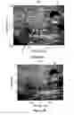 Fig. 10 - SYSTEMS, METHODS AND COMPUTER PROGRAM PRODUCTS FOR DOPPLER SPATIAL COHERENCE IMAGING