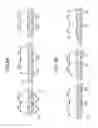 Fig. 10 - Coordinate detection apparatus