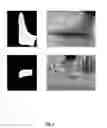 Fig. 05 - Systems and methods for generating orthotic device models from user-based data capture