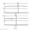 Fig. 04 - Method and device for detecting chromosomal structural abnormalities