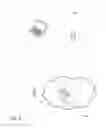 Fig. 12 - Selective access to medical symptom tracking data using dispersive storage area network (SAN)