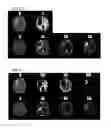 Fig. 09 - Processing imaging data to obtain tissue type information