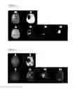 Fig. 10 - Processing imaging data to obtain tissue type information