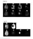 Fig. 11 - Processing imaging data to obtain tissue type information