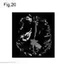 Fig. 15 - Processing imaging data to obtain tissue type information