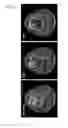 Fig. 24 - Processing imaging data to obtain tissue type information