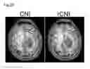 Fig. 25 - Processing imaging data to obtain tissue type information