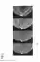 Fig. 07 - Method for generating a combined projection image and imaging device