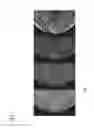 Fig. 08 - Method for generating a combined projection image and imaging device
