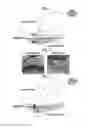Fig. 03 - Virtual endoscope image-generating device, method, and program