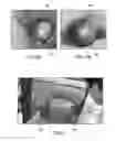 Fig. 07 - HYPERSPECTRAL IMAGER