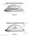 Fig. 07 - METHOD AND APPARATUS FOR EYE MODEL AND TESTING THEREOF
