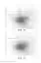 Fig. 08 - Arc evaporation source