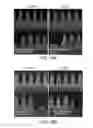 Fig. 16 - Internal plasma grid applications for semiconductor fabrication