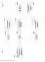 Fig. 05 - Sliding window list decoder for error correcting codes