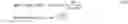 Fig. 11 - Background-differential extraction device and background-differential extraction method