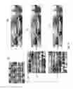 Fig. 24 - Camera system for three-dimensional video