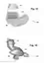 Fig. 16 - Custom earphone with dome in the canal