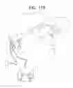 Fig. 166 - Biologically fit wearable electronics apparatus and methods