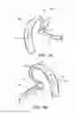 Fig. 02 - HEARING ASSISTIVE DEVICE AND SYSTEM