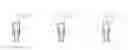 Fig. 02 - Adjustable gas spring, height-adjustable column with gas pressure spring, and furniture with height-adjustable column
