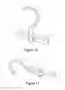 Fig. 14 - Hanger