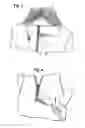 Fig. 03 - Zipper assist device