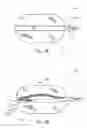 Fig. 03 - Tissue Dispenser for Enabling Tissue Dispension for Persons with Restricted Hand Movement