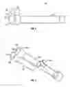 Fig. 03 - A GAS AND LIQUID SUPPLY SYSTEM FOR AN ENDOSCOPE