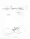 Fig. 11 - SYSTEMS AND METHODS FOR OPTIMIZING AND MAINTAINING VISUALIZATION OF A SURGICAL FIELD DURING THE USE OF SURGICAL SCOPES