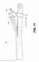 Fig. 13 - Medical systems comprising optical devices