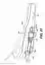 Fig. 32 - Medical systems comprising optical devices