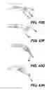 Fig. 42 - Medical systems comprising optical devices