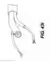 Fig. 43 - Medical systems comprising optical devices