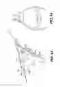 Fig. 52 - Medical systems comprising optical devices