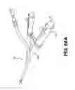 Fig. 67 - Medical systems comprising optical devices