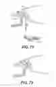 Fig. 72 - Medical systems comprising optical devices