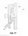 Fig. 76 - Medical systems comprising optical devices