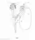 Fig. 04 - Endoscope mountable visualization device quick-connect/release handle attachment mechanism