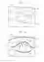 Fig. 10 - Endoscope system and method for operating the same