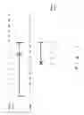 Fig. 02 - Method for measuring visual acuity