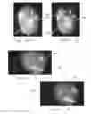 Fig. 06 - Reduced glare surgical microscope and associated devices, systems, and methods
