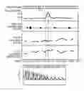 Fig. 01 - BIOLOGICAL INFORMATION DETECTING DEVICE