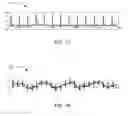 Fig. 02 - Electrocardiograph (ECG) signal processing