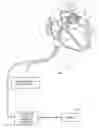 Fig. 01 - Enhanced activation onset time optimization by similarity based pattern matching